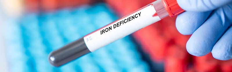 Can Iron Deficiency Cause Extreme Fatigue?