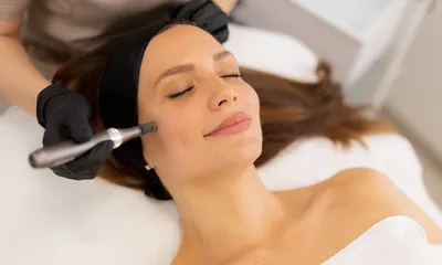 Does Microneedling Help Hyperpigmentation