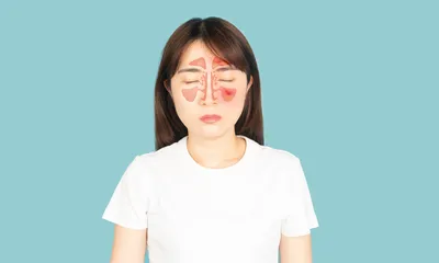 How Long is a Bacterial Sinus Infection Contagious