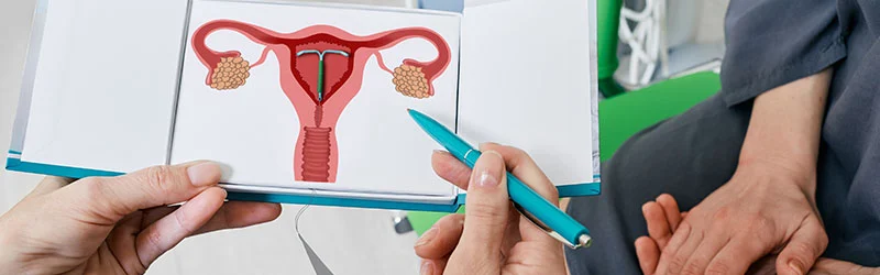 Kyleena vs Mirena: Do These IUDs Cause Weight Gain