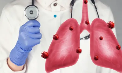 Is Tuberculosis a Cancer