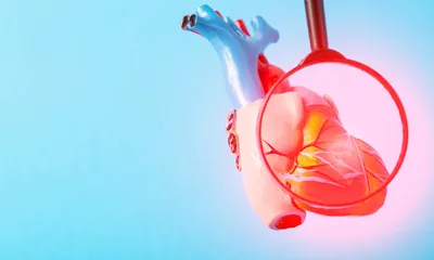 What is the Difference Between Angina and a Heart Attack