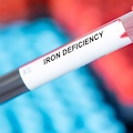 Can Iron Deficiency Cause Extreme Fatigue?