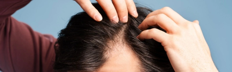 Does Zenpep Cause Hair Loss? A Tangled Tale 