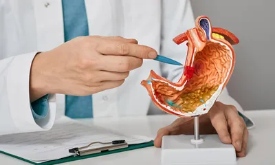 Can a Stomach Ulcer Cause Weight Gain