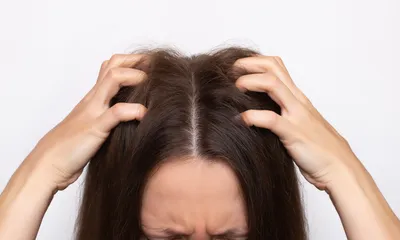 Is Short Hair Better for Scalp Psoriasis