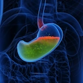 What Is Acid Reflux? Symptoms, Causes, and When to Seek Help