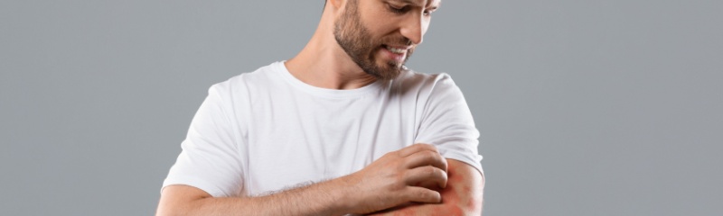 What Is Protopic Ointment - What Is Protopic Ointment Used For What Is Protopic Ointment - What Is Protopic Ointment Used For