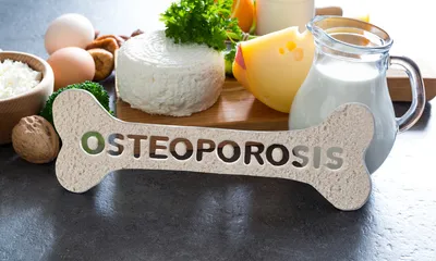 Does Osteoporosis Affect Your Teeth