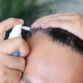 Is Oral Minoxidil Better Than Topical? Compare Options