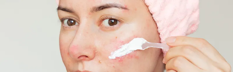 How to Apply Soolantra Cream How to Apply Soolantra Cream