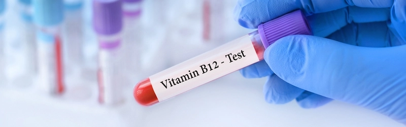 What Is the Treatment for High Vitamin B12? What Is the Treatment for High Vitamin B12?