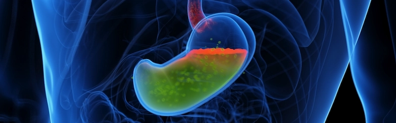 What Is Acid Reflux? Symptoms, Causes, and When to Seek Help