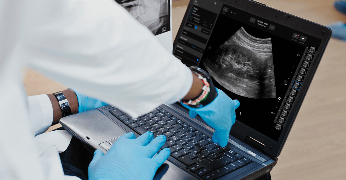 Ultrasound Workflow Exo Works