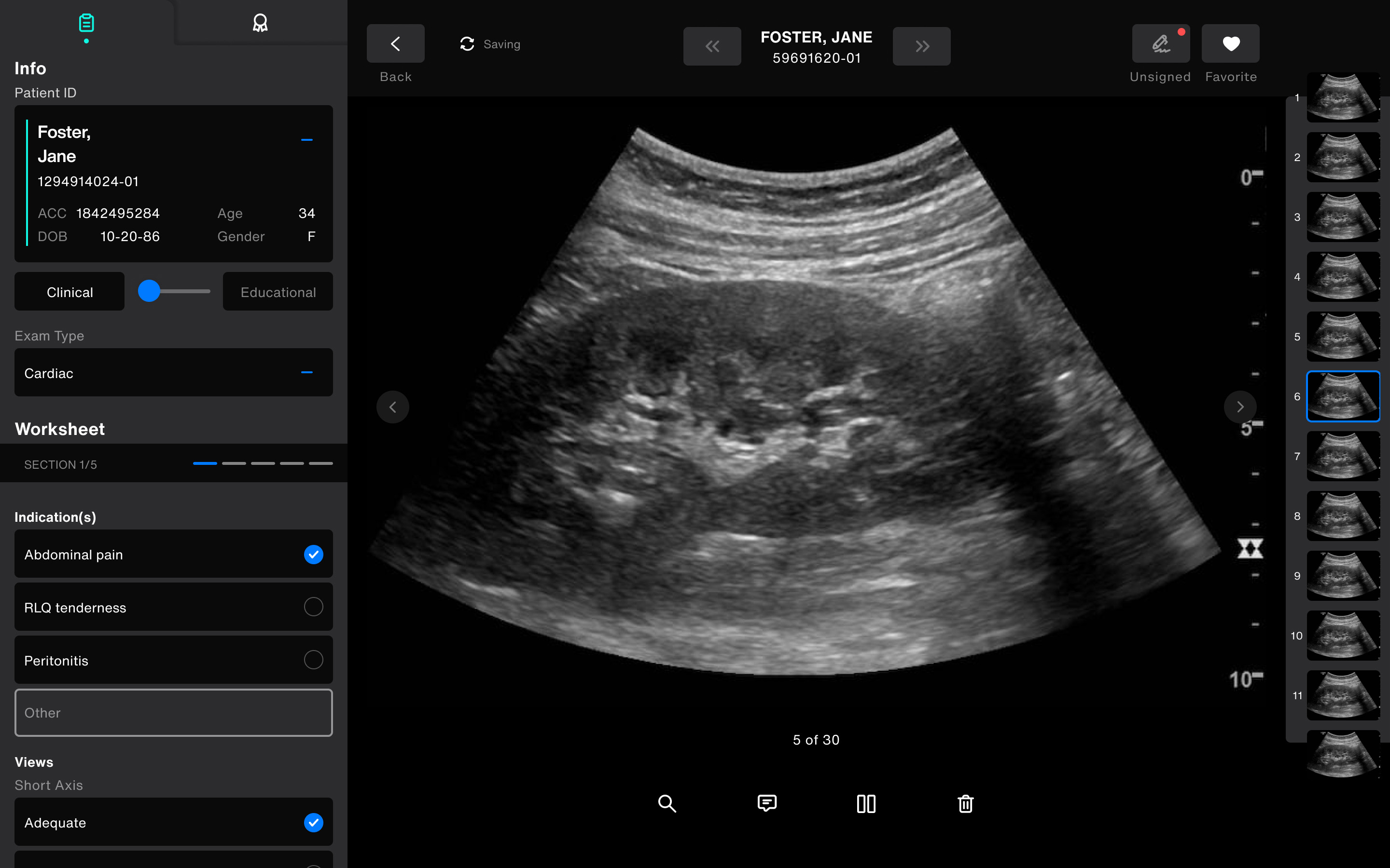 Ultrasound Workflow Exo Works