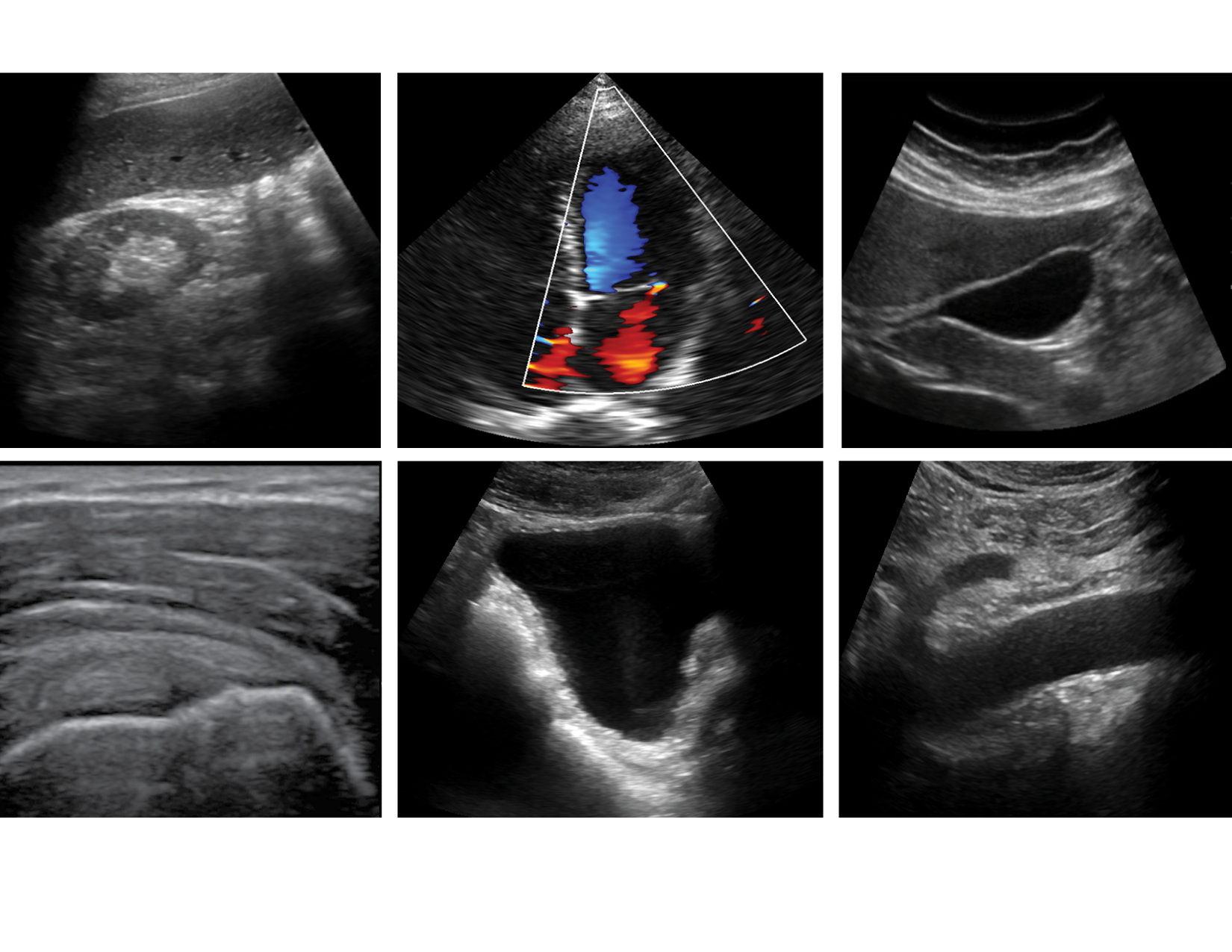 Are Handheld Ultrasounds Accurate?