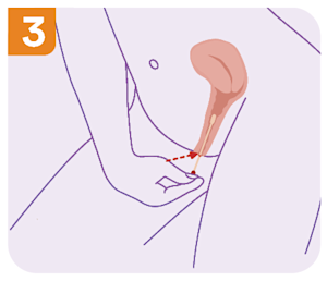 self collect step 3