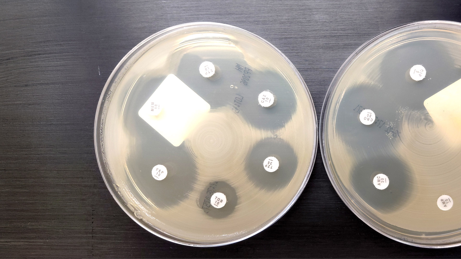 Path Focus June 2026 - Antibiotic Susceptibility Testing Article