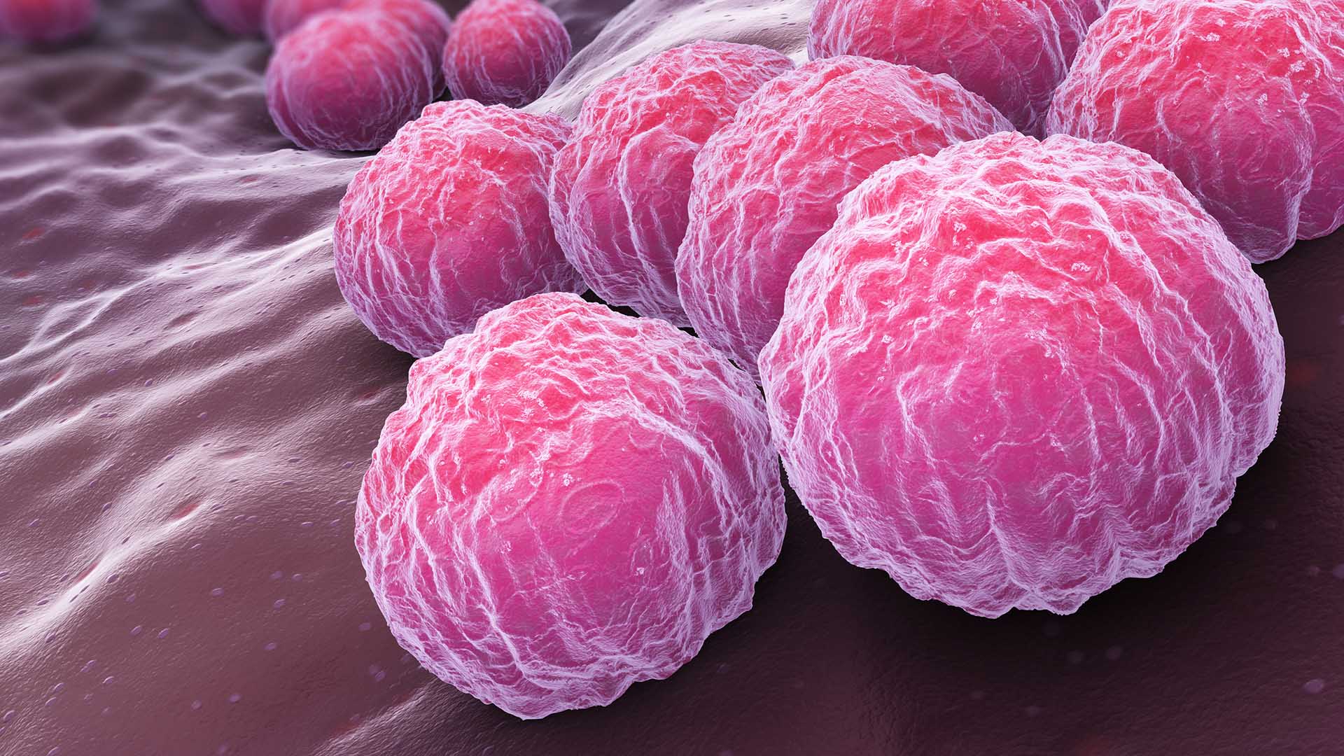 Chlamydia