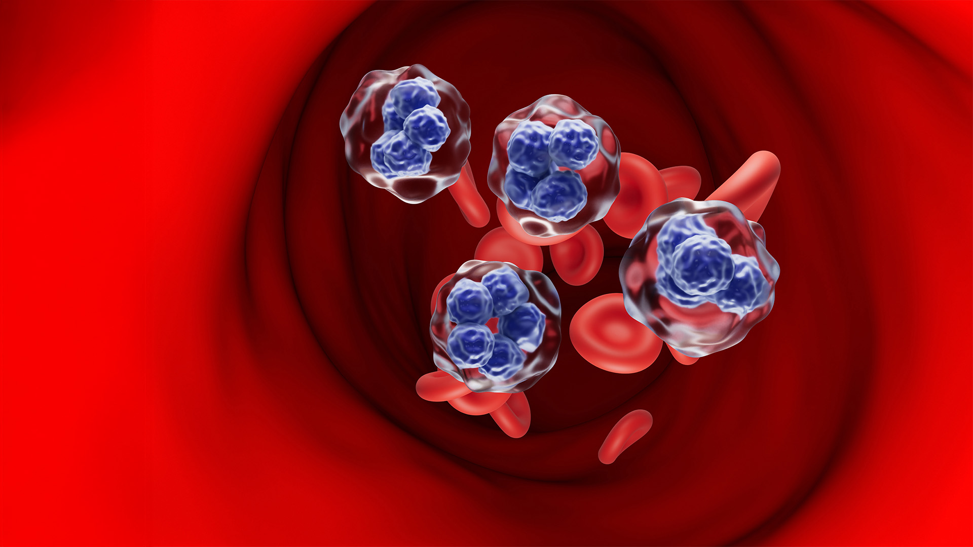 Blood cancer 2