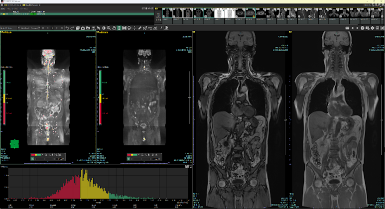富士フイルム、AIプラットフォーム「SYNAPSE SAI viewer Ver2.7」を提供開始、MRI・CT画像読影支援機能を拡充 ...
