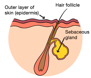 Diagram of a Spot<br />