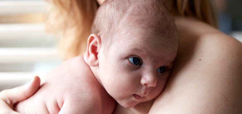 Cradle Cap: Causes & Symptoms