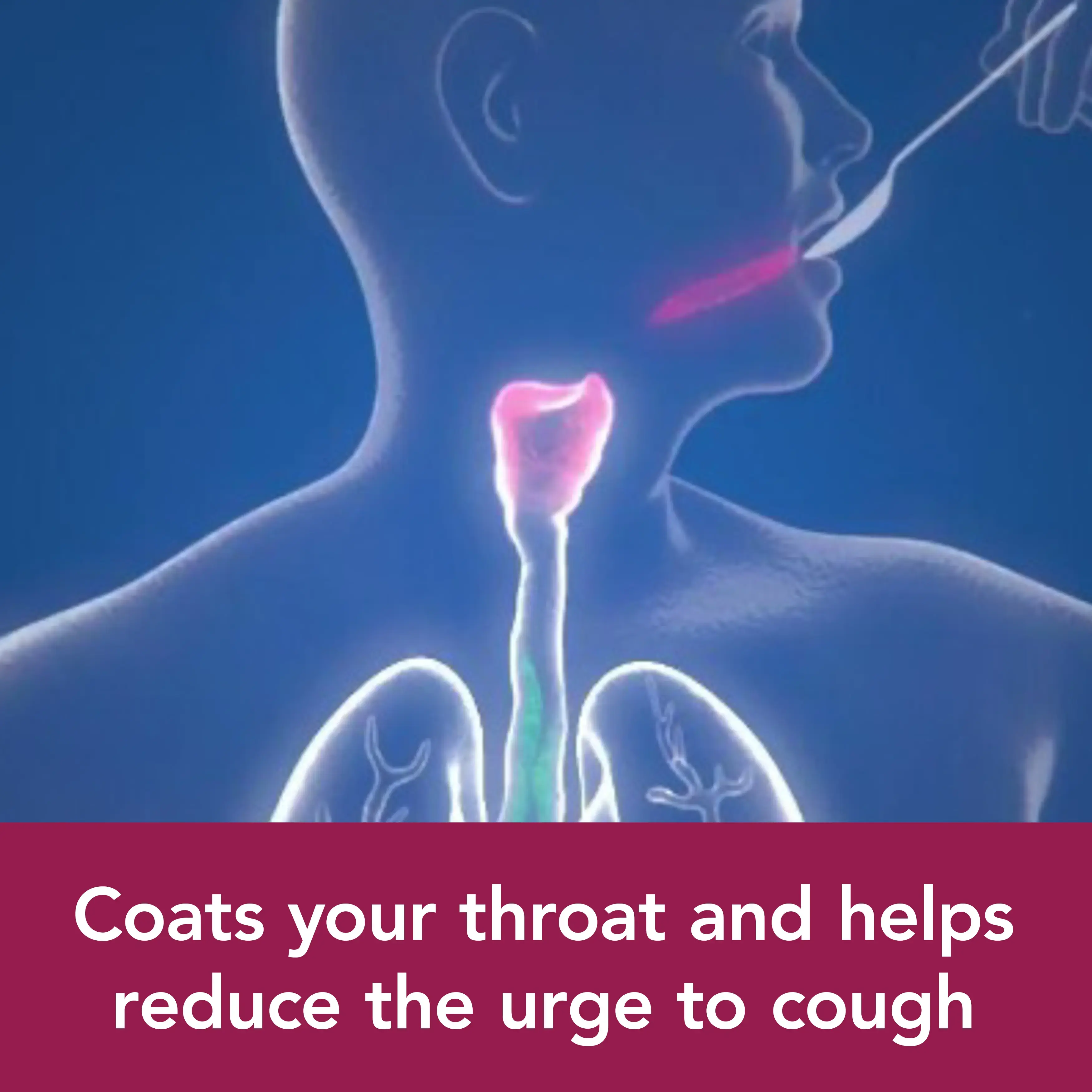 Image showing what Benylin Dry and Tickly Cough Syrup does