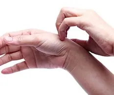 Itchy skin can be a symptom of allergies