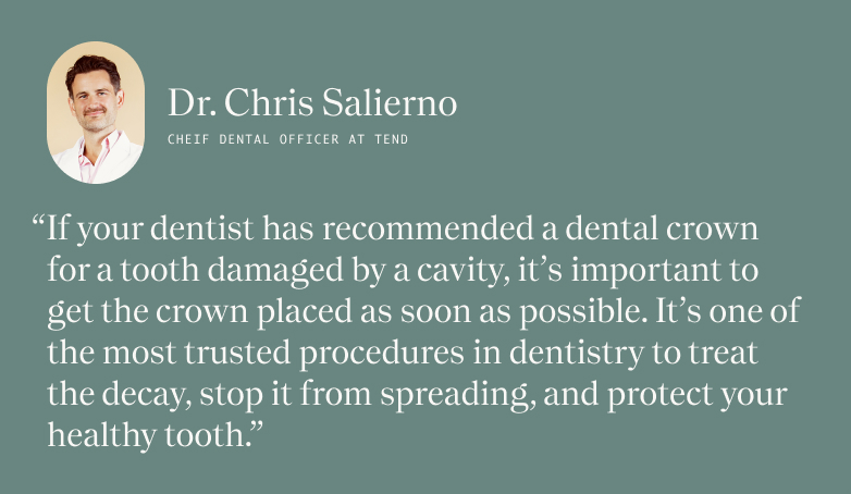 Dr Chris Salierno Quote Dental Crowns