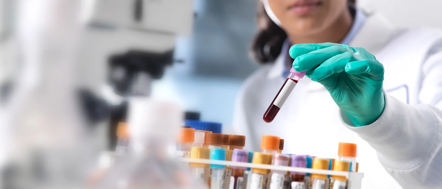 cure-hp-carousel-liquid-biopsys-white-paper