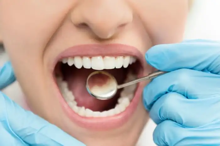 Czy implanty zębów bolą? article banner