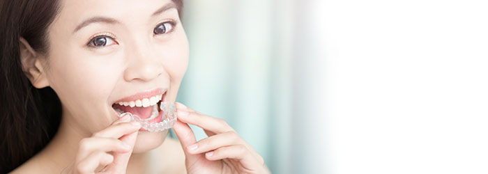 Image - Article Hero - Teeth retainer to straighten teeth article banner