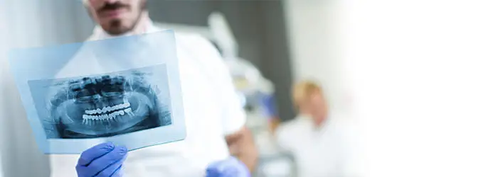 Rentgen stomatologiczny: Jak działa, kiedy robić 
