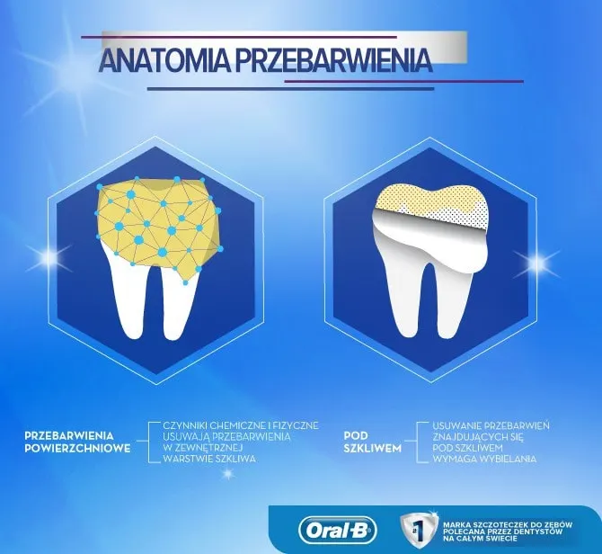 Na czym polega wybielanie zębów?