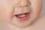 La poussée dentaire chez les bébés