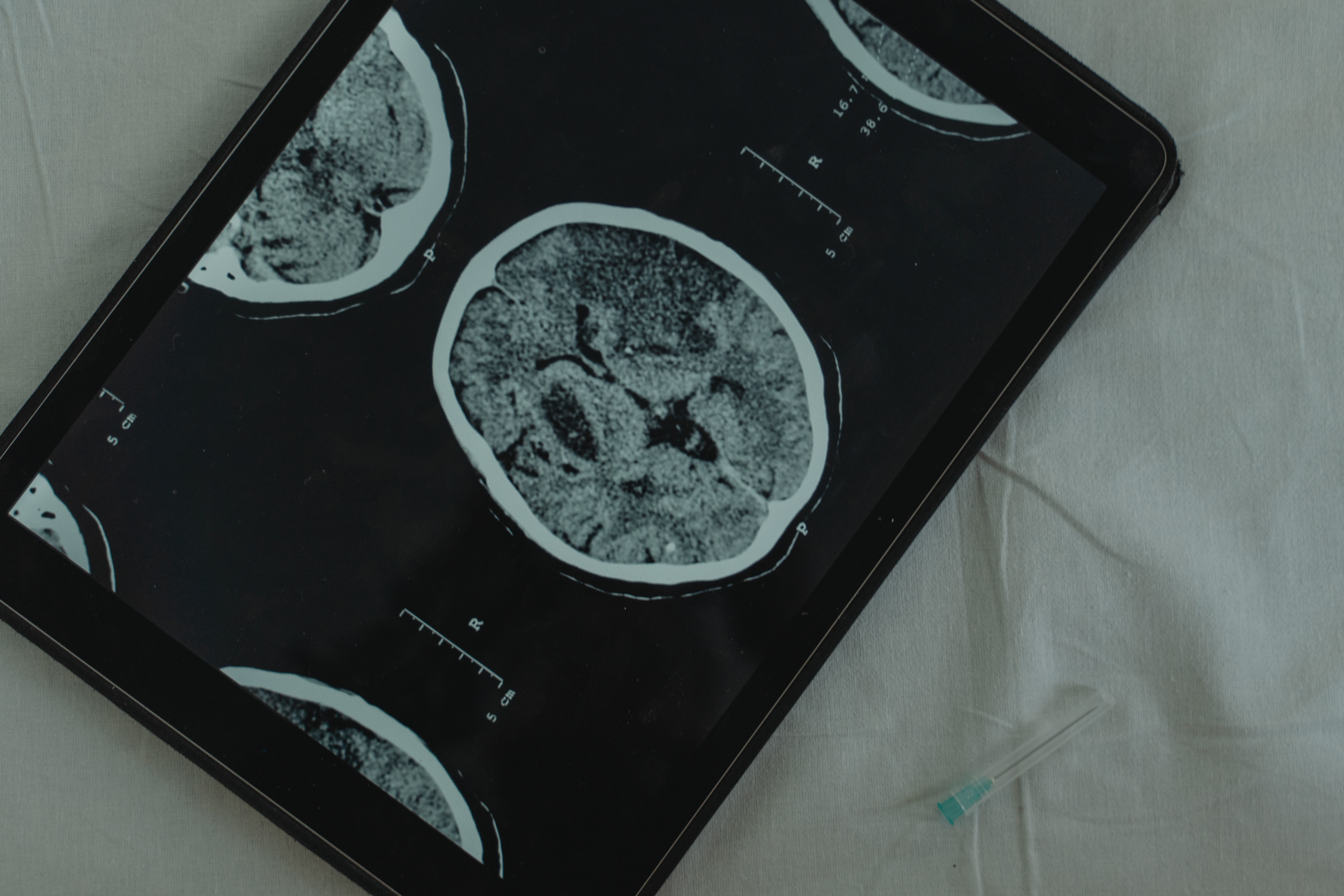 scan of a brain shown on tablet