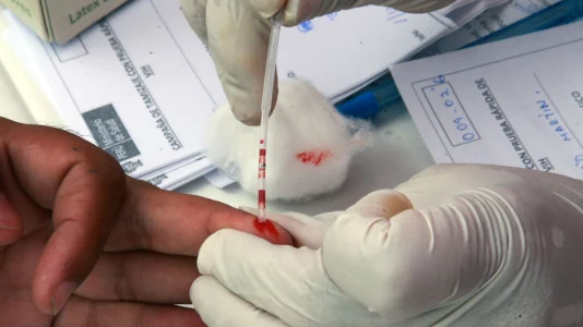 Trece personas fallecieron por complicaciones del VIH este año en Puno