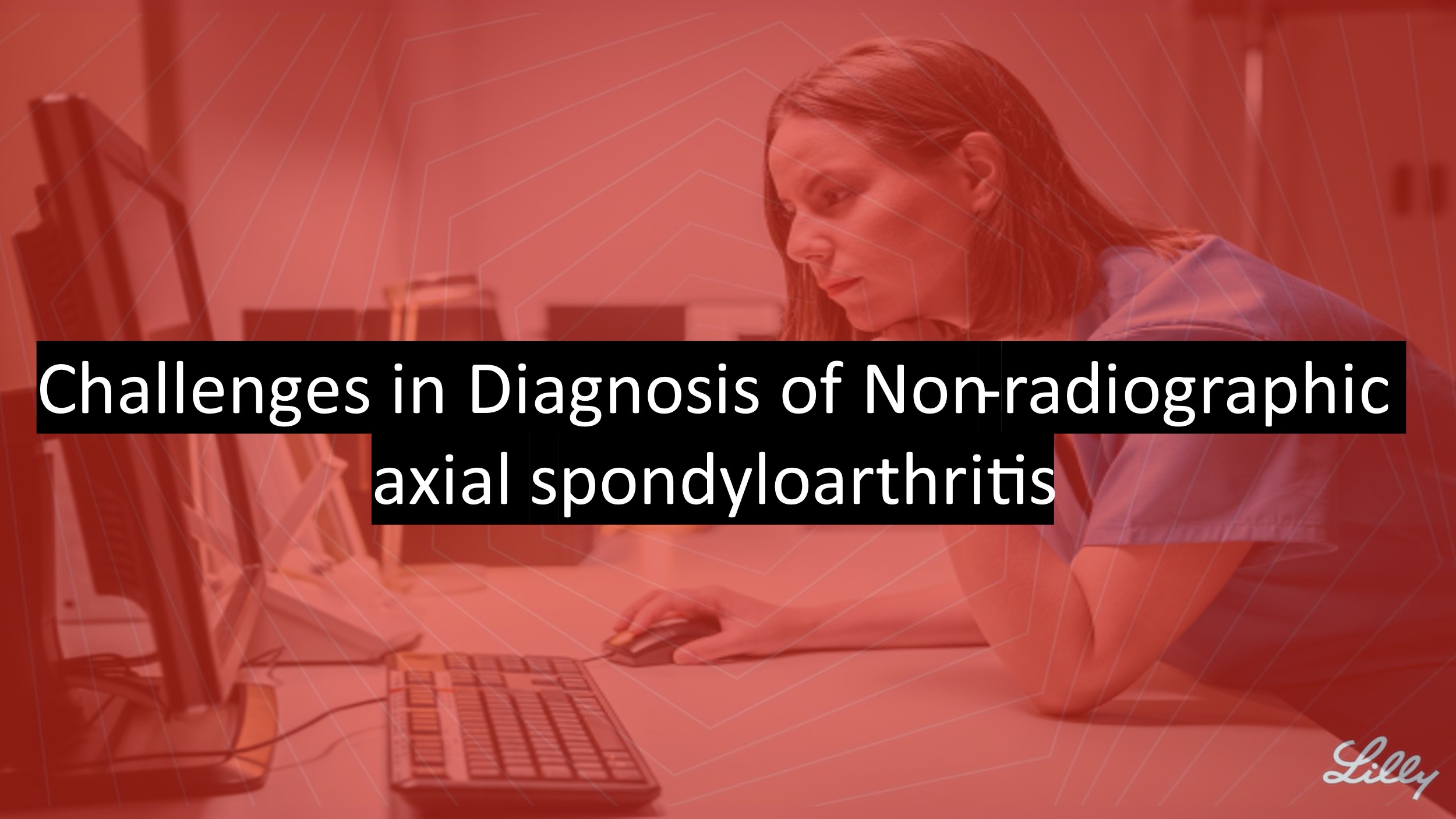 Challenges in Diagnosis of Non-Radiographic axSpA