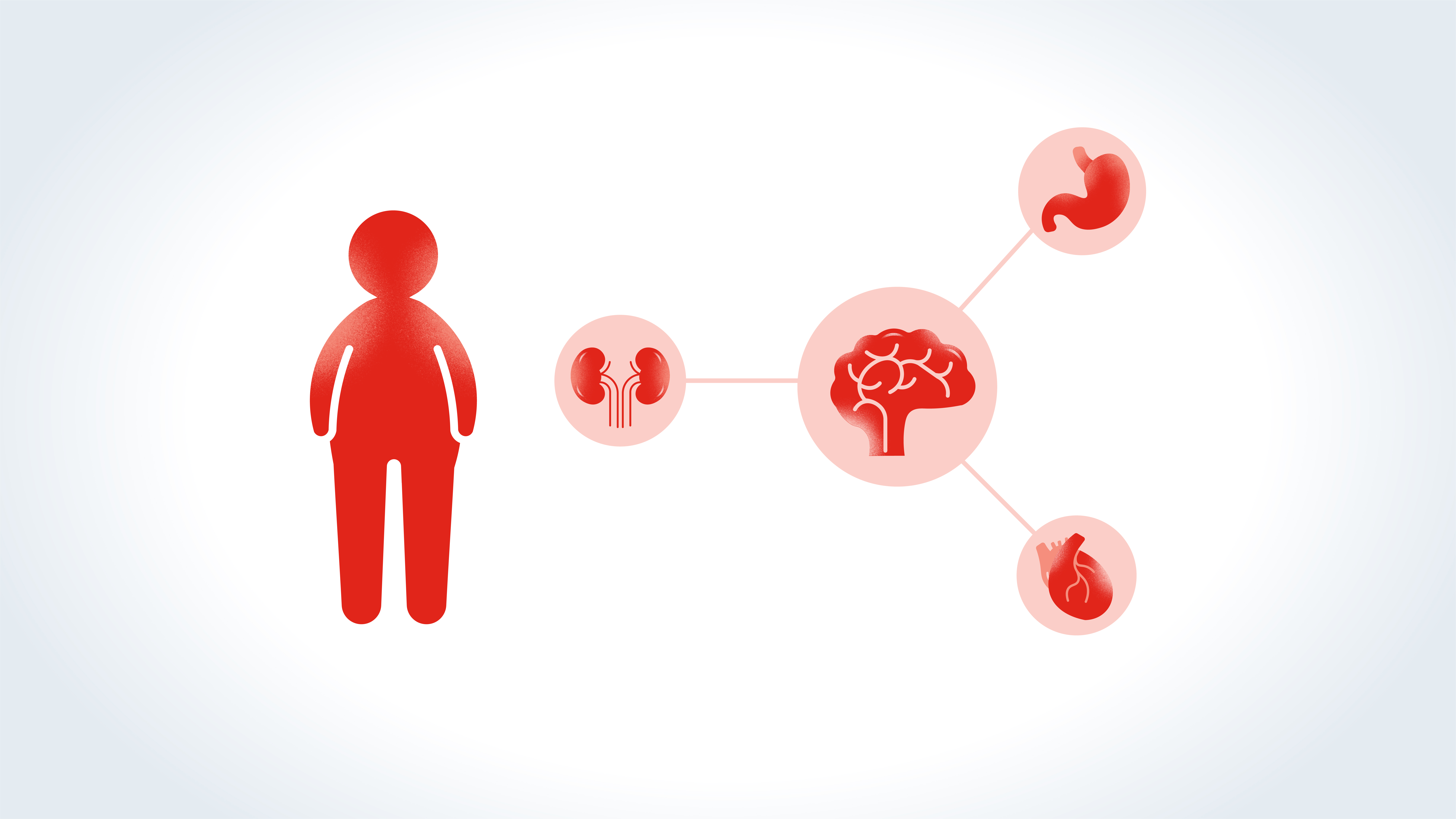 Obesity has a multifactorial origin. It can be influenced by genetic, epigenetic, environmental, physiological, behavioral, and sociocultural factors.