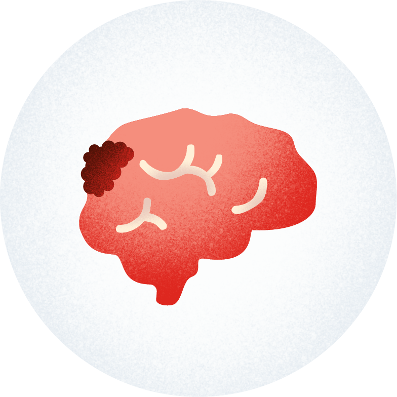Icon of a brain with tumor