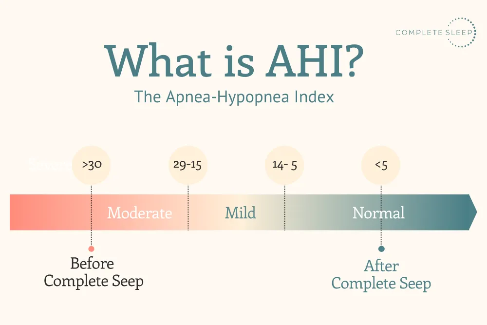 The ultimate guide to understanding your sleep study report | Complete ...