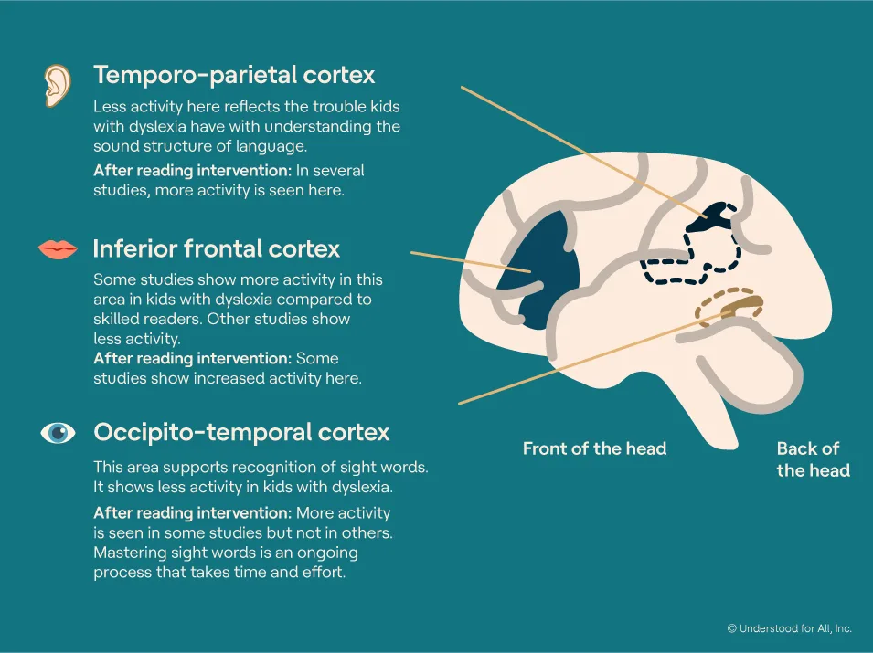 How Reading Changes The Brain how-reading-changes-the-brain