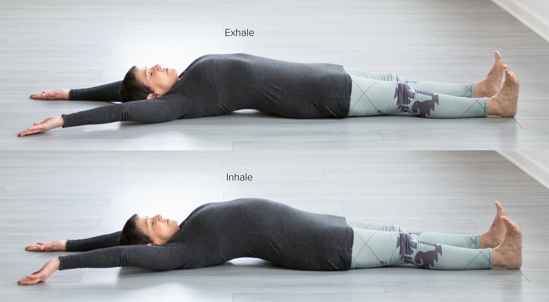 Yoga Therapy For Hernia - An Overview, Common Types and Treatment – Grocare®