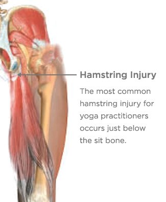 Anatomy of the Hamstring & Upper Leg