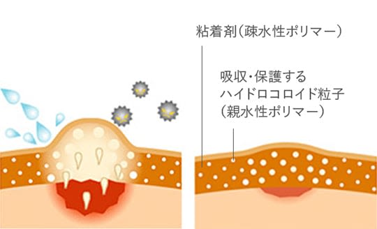 band-aid_kizupowerpad_hydrocolloid