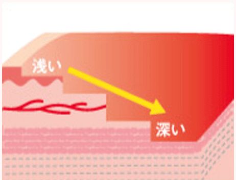 ケア方法