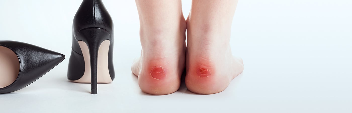 靴ずれは、キズパワーパッドTMで治そう！ | バンドエイド® BAND-AID®