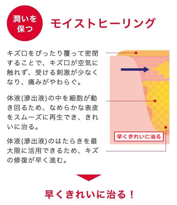 バンドエイド® キズパワーパッド™ モイストヒーリング