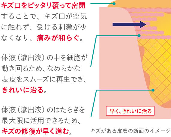 モイストヒーリング